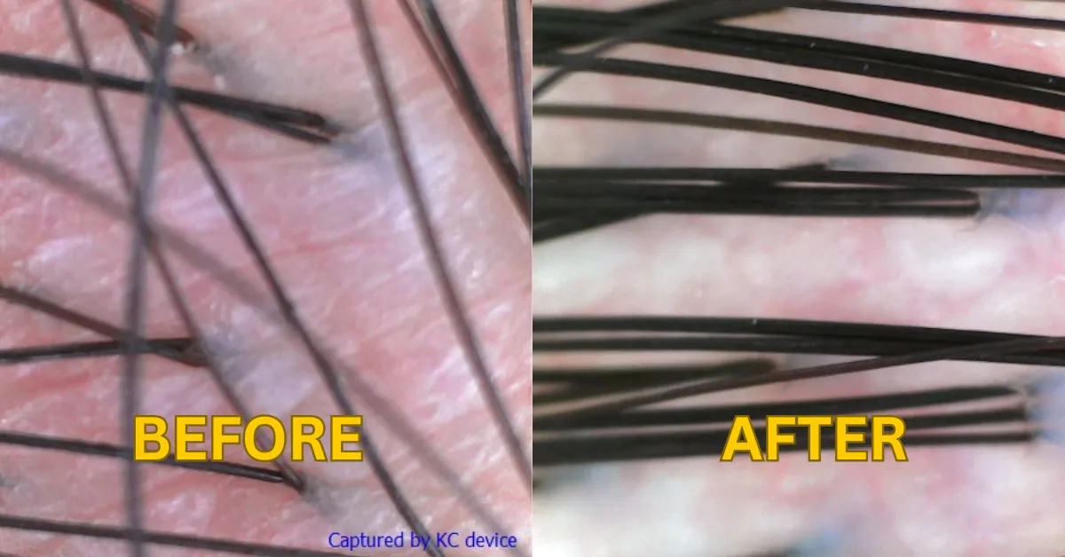 TK TrichoKare’s Restorative Hydration Treatment