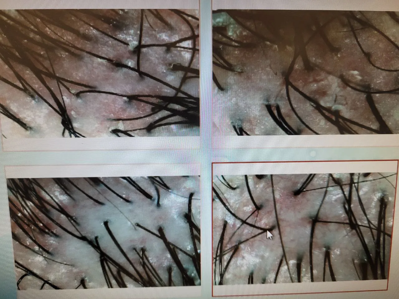 Scalp close-up