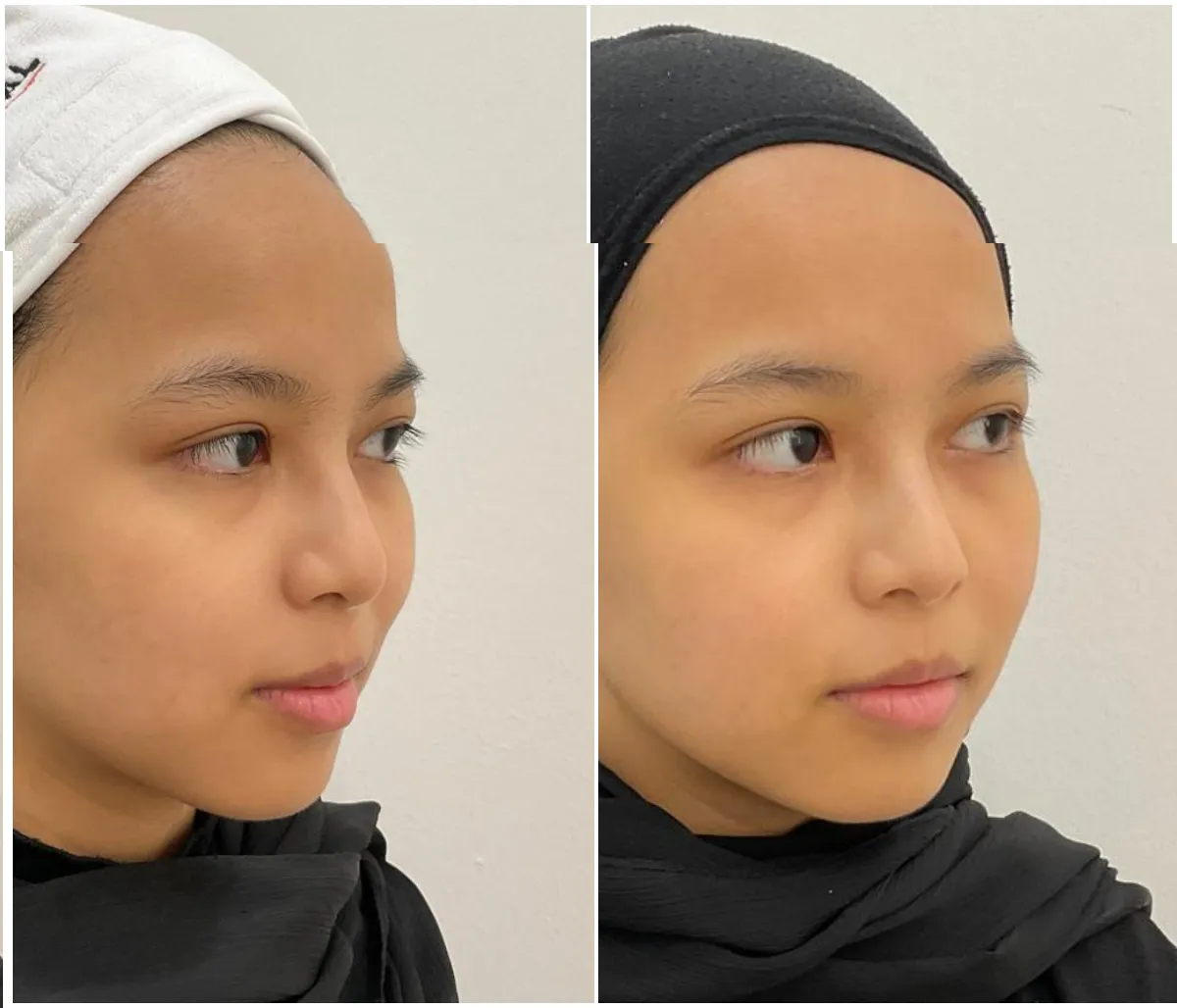 Credit: 21 Aesthetics Singapore